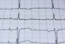 stellar node 999999999 hyper pulse